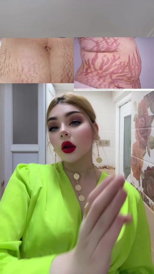 TikTok video thumbnail by kabkabwi