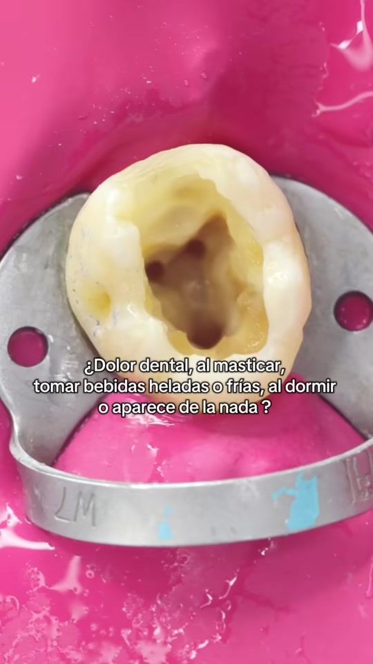 TikTok video thumbnail by perfect_dentika