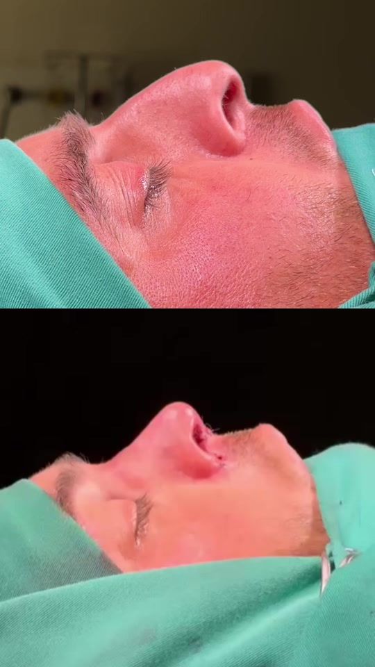 TikTok video thumbnail by dr.qahraman