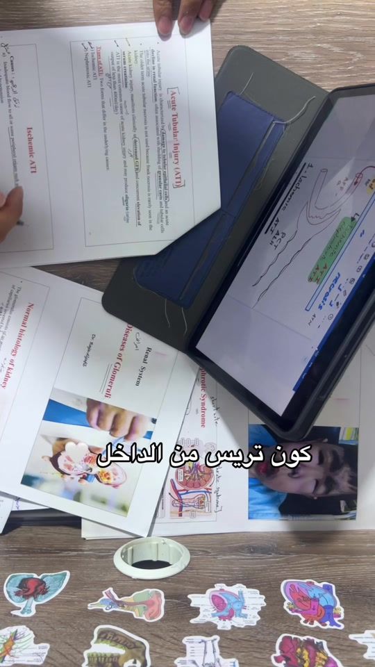 TikTok video thumbnail by eslam_aboukamar_6