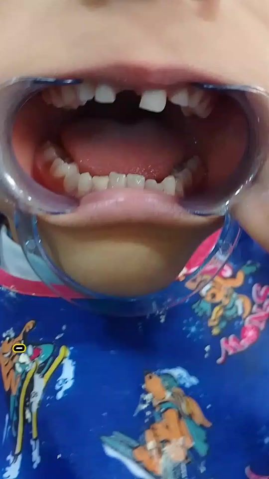 TikTok video thumbnail by escudental