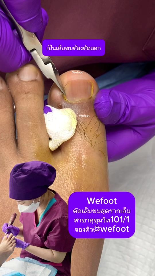 TikTok video thumbnail by wefoot8