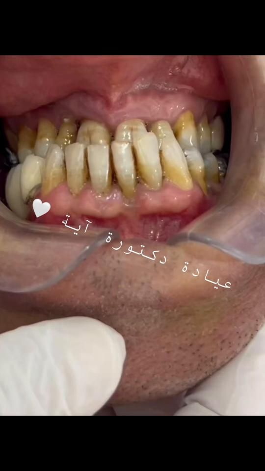 TikTok video thumbnail by dr.eya.clinic
