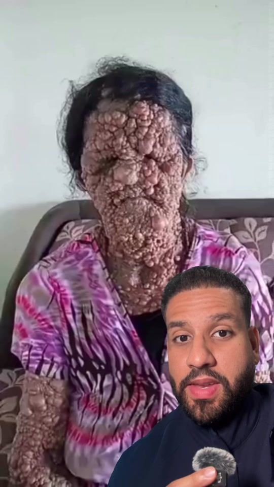 TikTok video thumbnail by doctor.humber