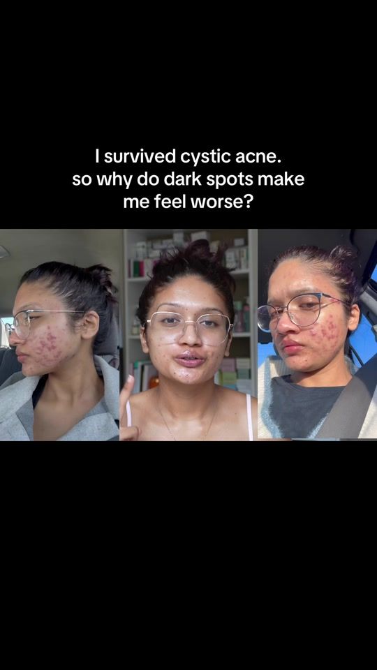 TikTok video thumbnail by glowjournalmamata
