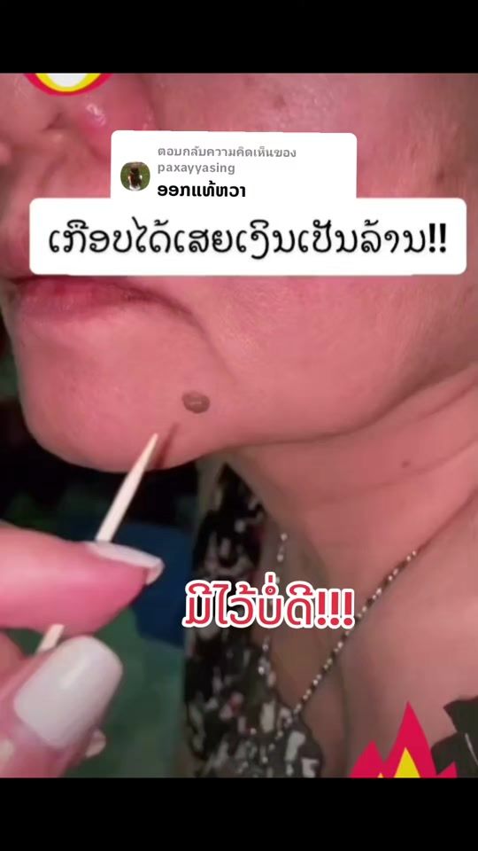 TikTok video thumbnail by onny_6