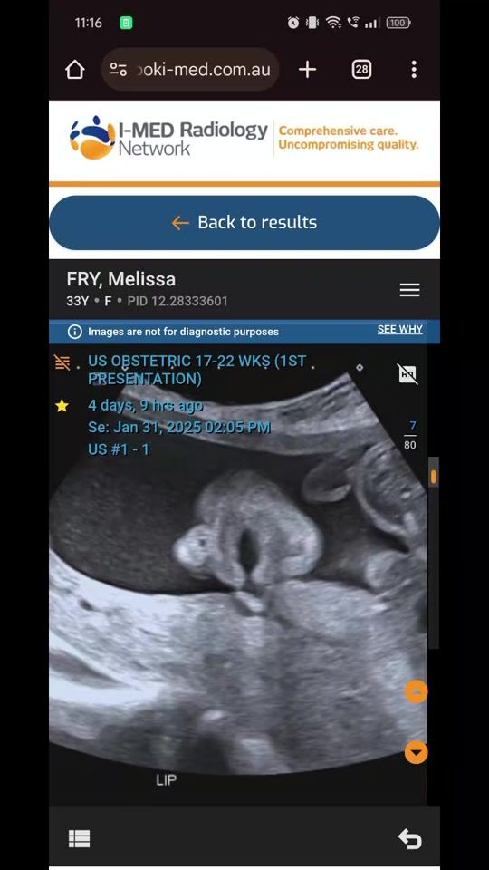 TikTok video thumbnail by queenmel1991