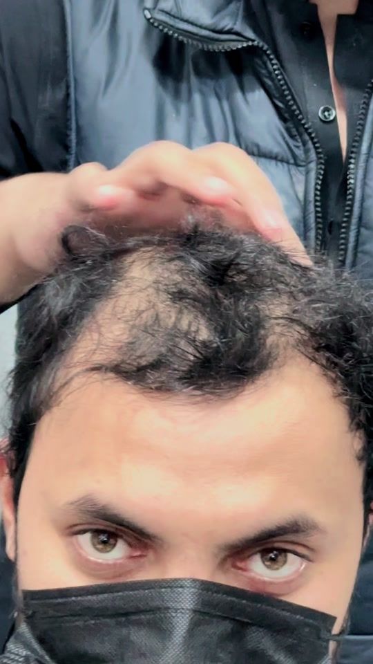 TikTok video thumbnail by hairsolutionclub9