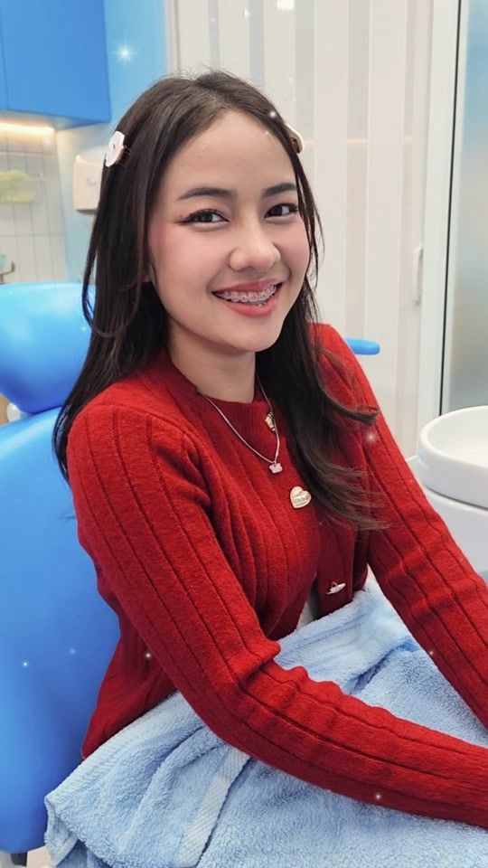 TikTok video thumbnail by bluetoothdentclinic