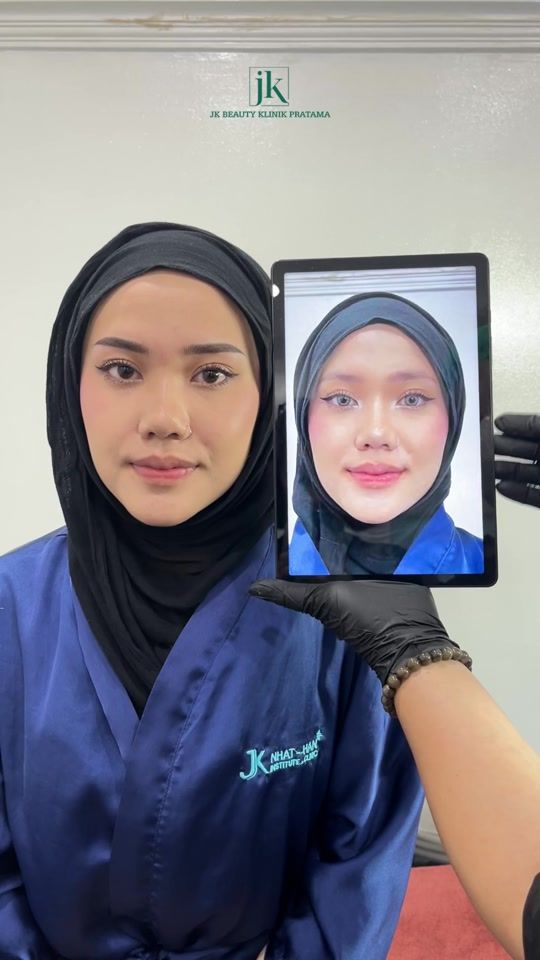 TikTok video thumbnail by jkbeautycenterindonesia