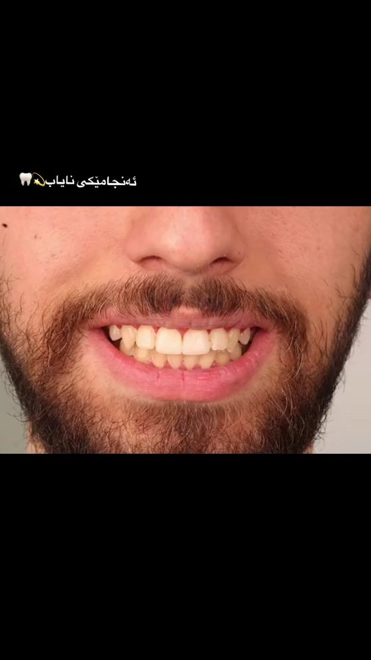 TikTok video thumbnail by drdaryadlzar