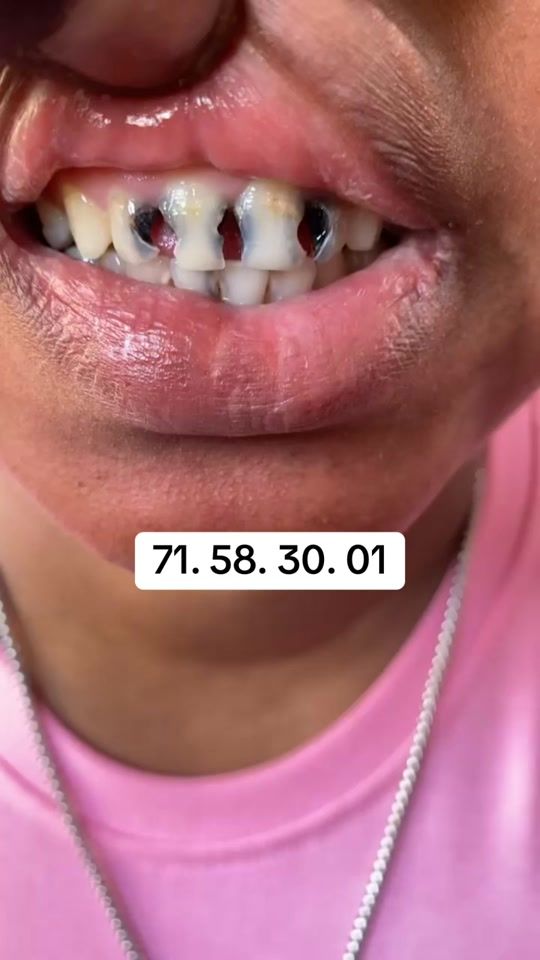 TikTok video thumbnail by roikaou.09