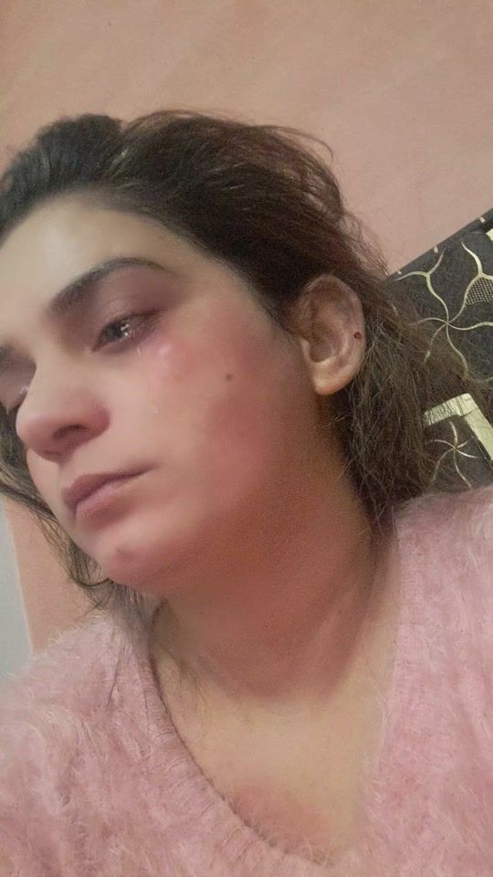 TikTok video thumbnail by shahzadisialkoti786