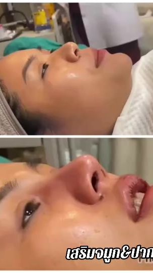 TikTok video thumbnail by doctorgclinic1