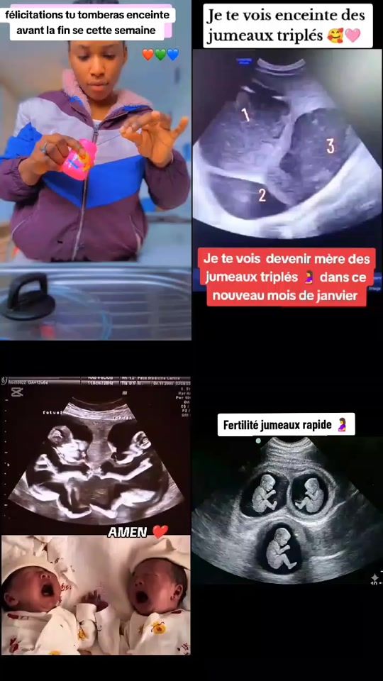 TikTok video thumbnail by docteur.agougou