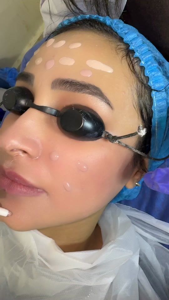 TikTok video thumbnail by dr.ayamostafa