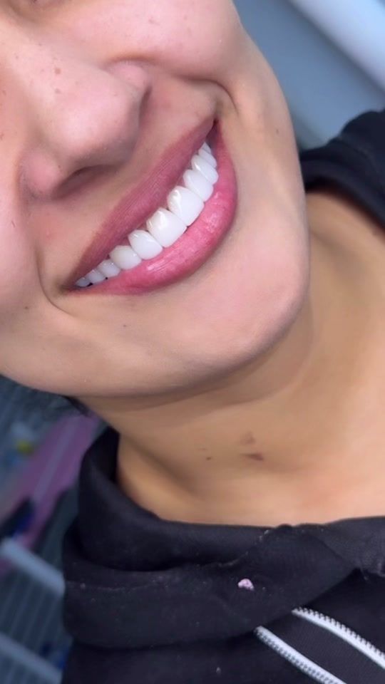 TikTok video thumbnail by dentalgesthetic