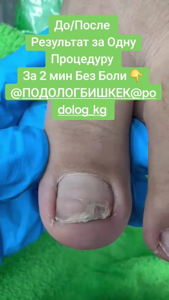 TikTok video thumbnail by podolive.kg