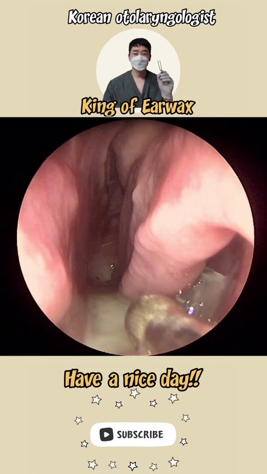 TikTok video thumbnail by king_of_earwax