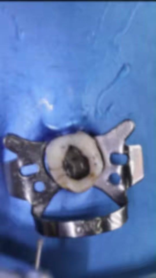 TikTok video thumbnail by perfect_dentika