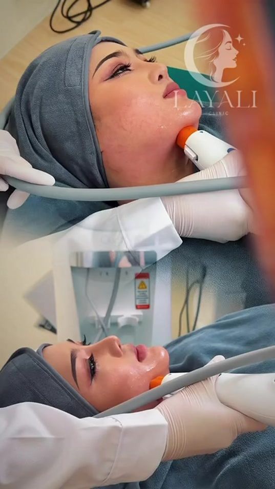 TikTok video thumbnail by nr.9918