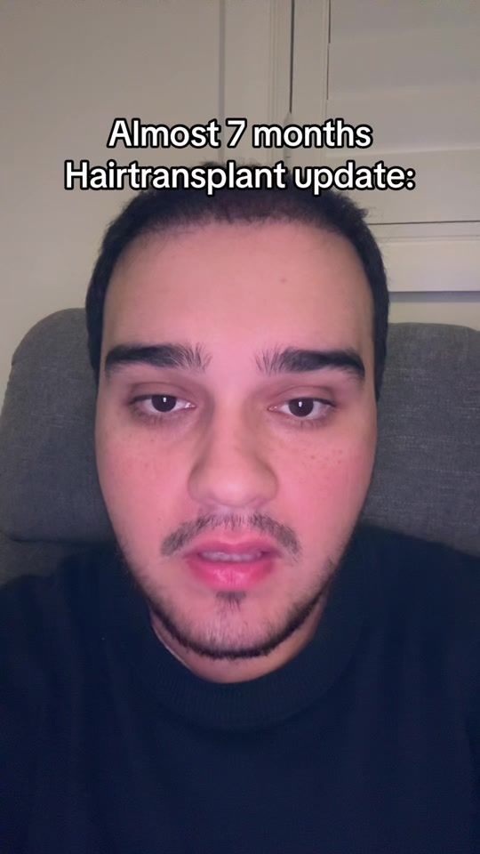 TikTok video thumbnail by tiktokhuss