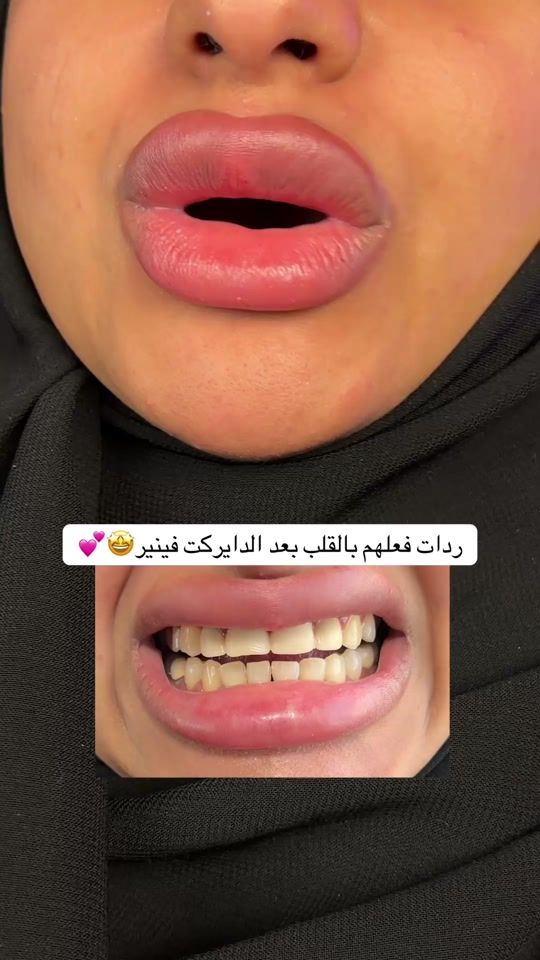 TikTok video thumbnail by albaclinics