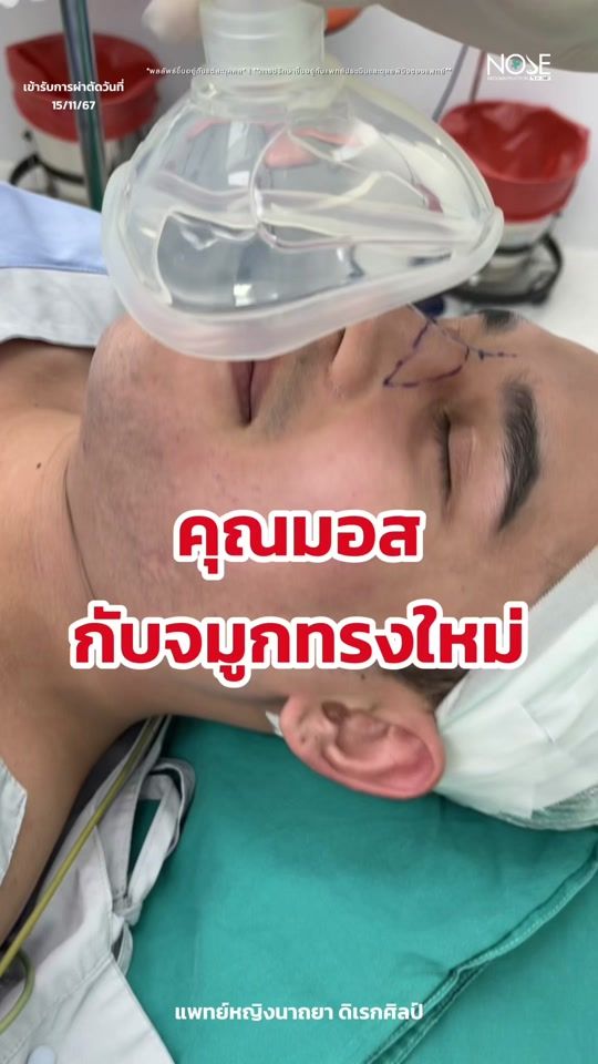 TikTok video thumbnail by rhinoplastybymasterpiece
