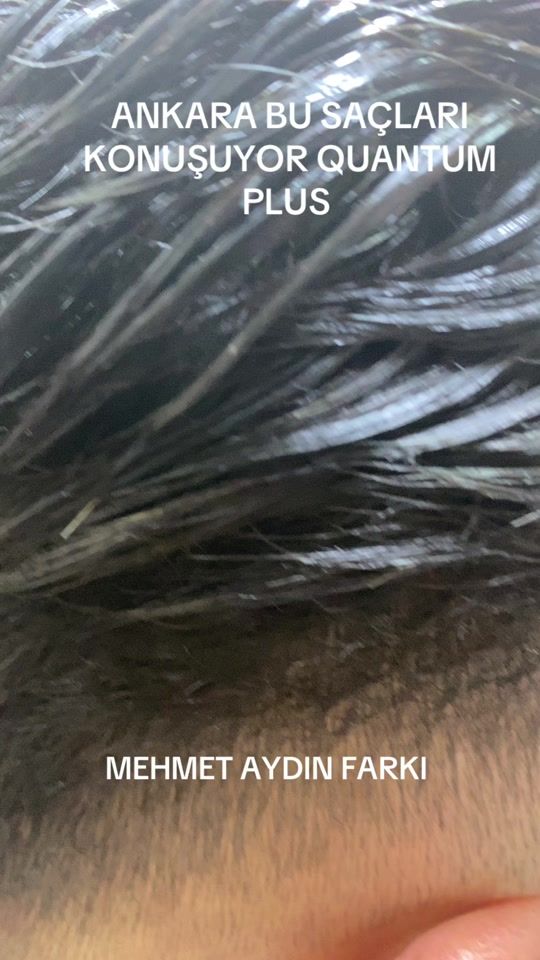 TikTok video thumbnail by m.aydn006