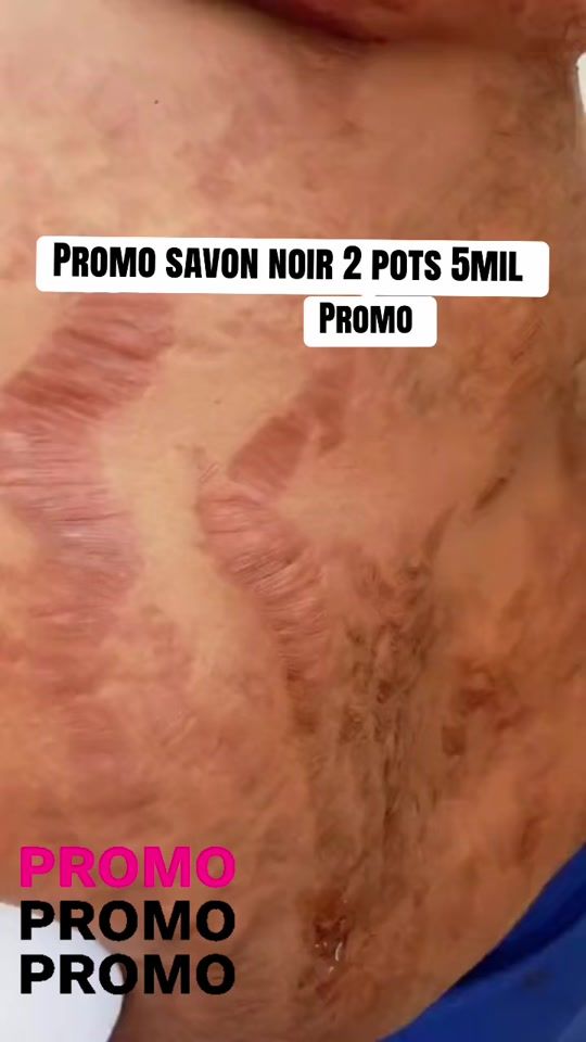 TikTok video thumbnail by natural_skin4