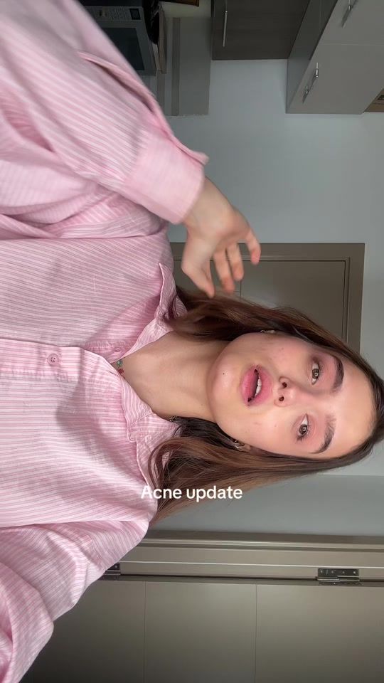 TikTok video thumbnail by zeinebnoomen
