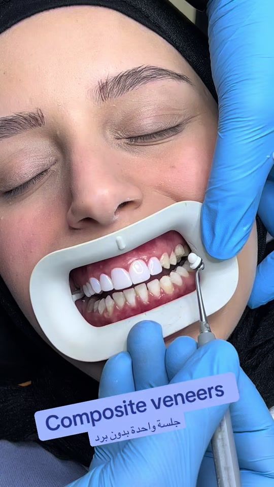 TikTok video thumbnail by clinics2020