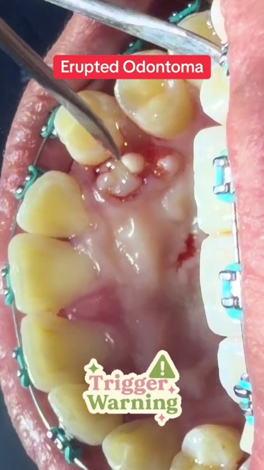 TikTok video thumbnail by doc_jhing