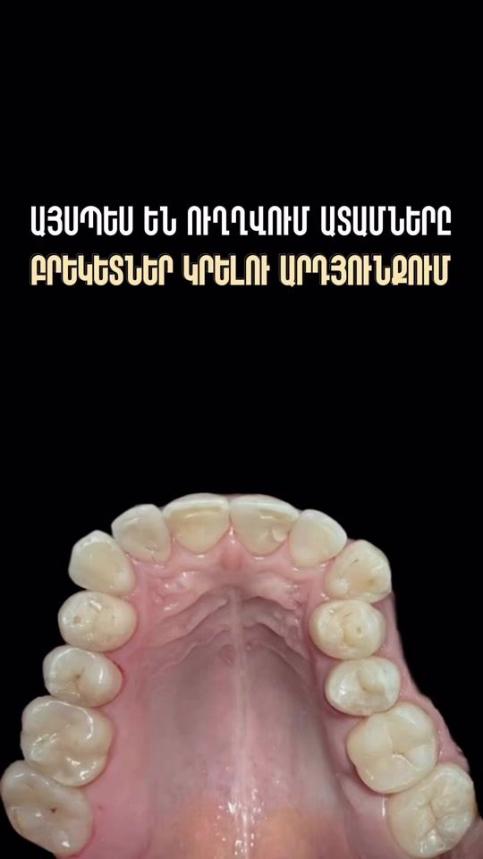 TikTok video thumbnail by elix_clinic