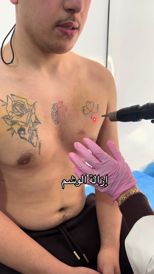TikTok video thumbnail by dr.chaallel