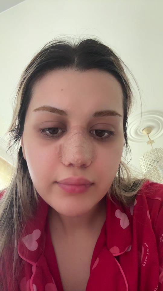 TikTok video thumbnail by melisaxturan