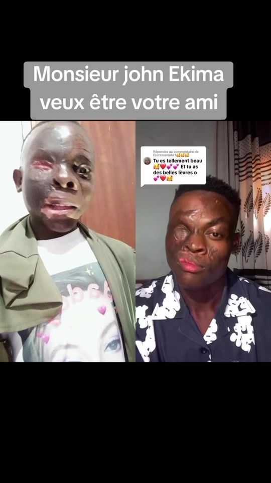TikTok video thumbnail by orphelinat.bukavu.afpd