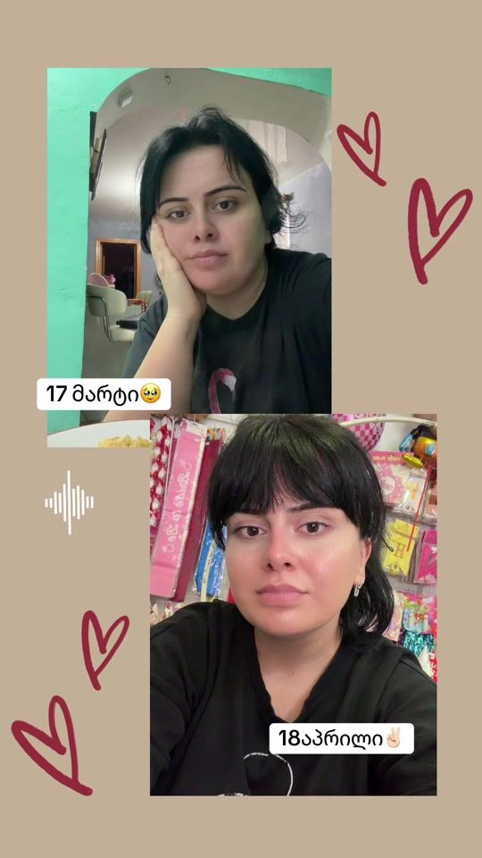TikTok video thumbnail by qirialiku