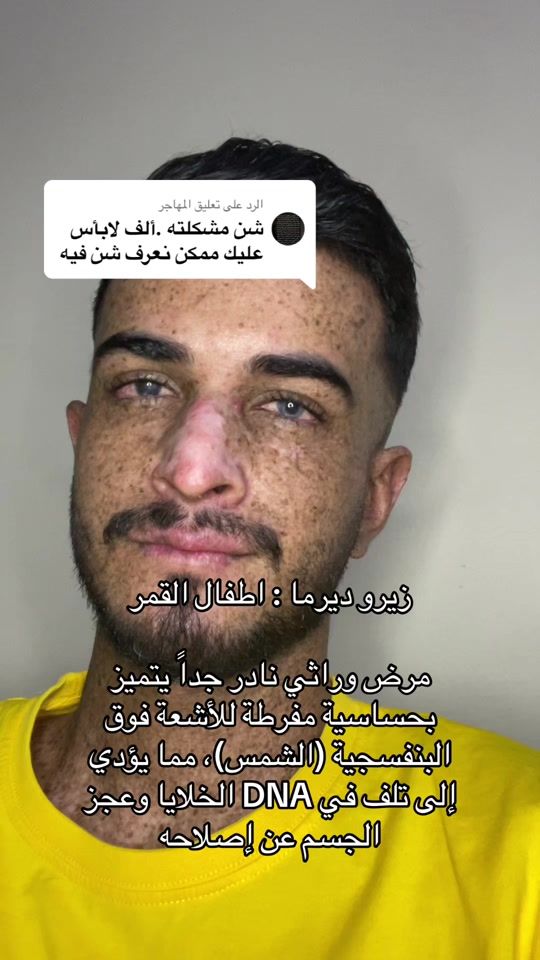 TikTok video thumbnail by t67r1