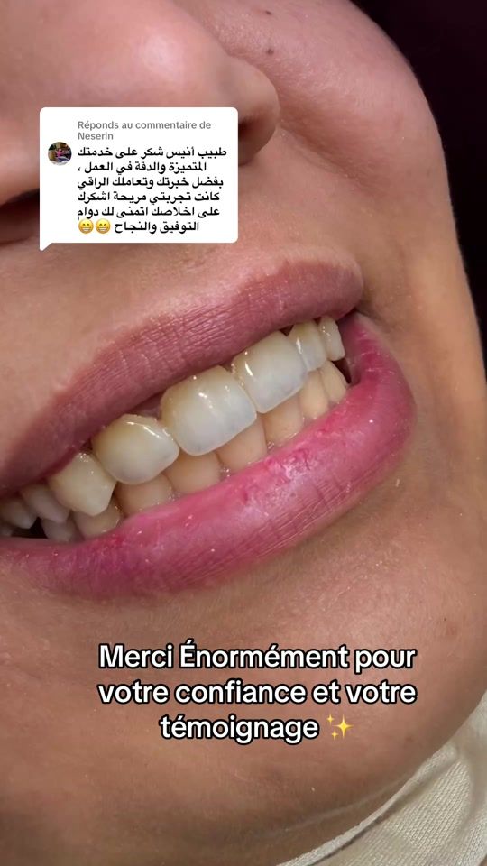 TikTok video thumbnail by dr.ben_anis