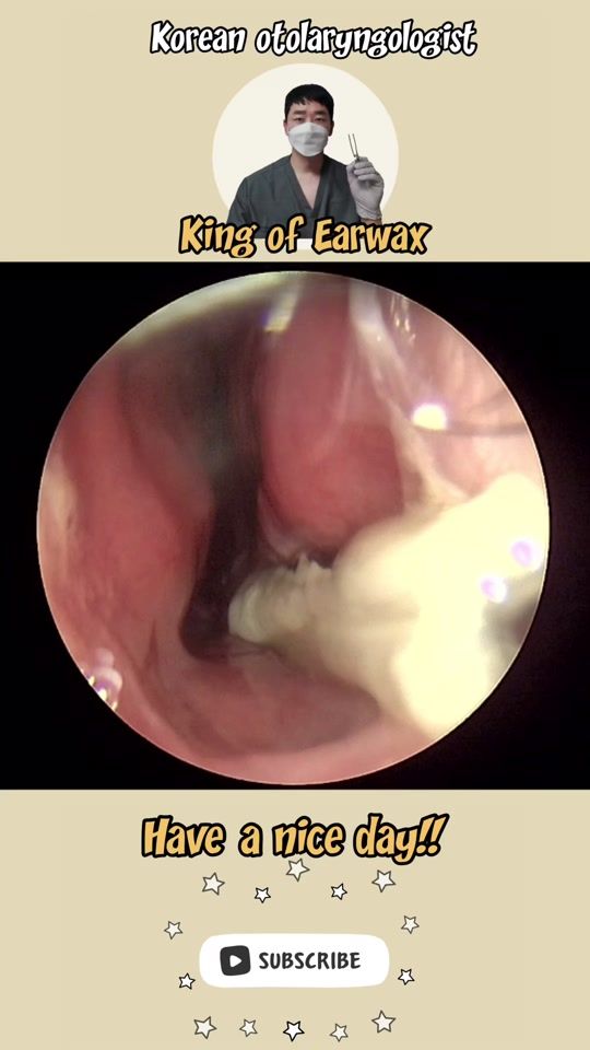 TikTok video thumbnail by king_of_earwax