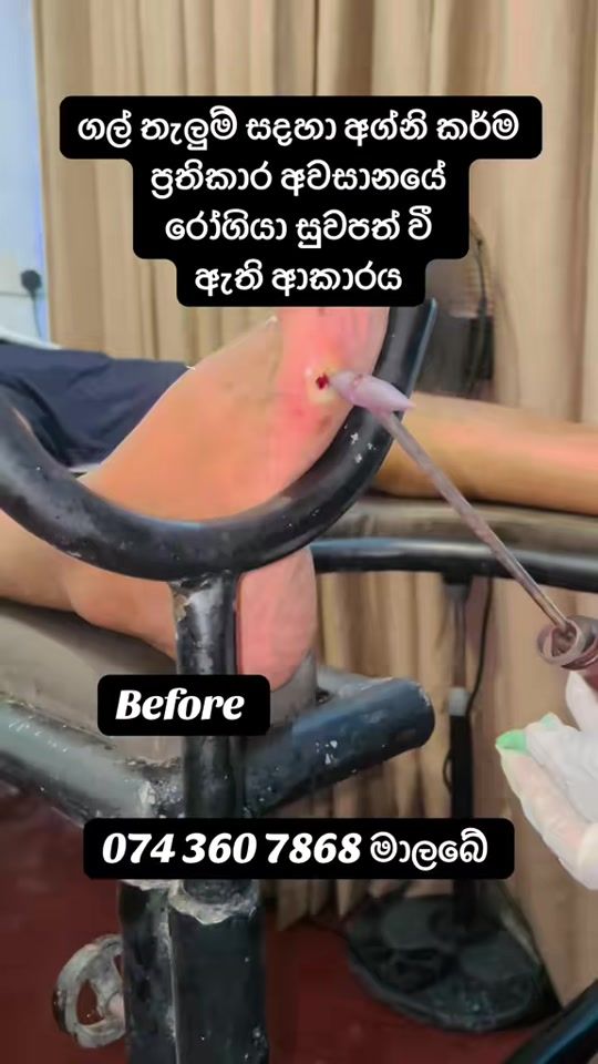 TikTok video thumbnail by drmaneeshakooragoda