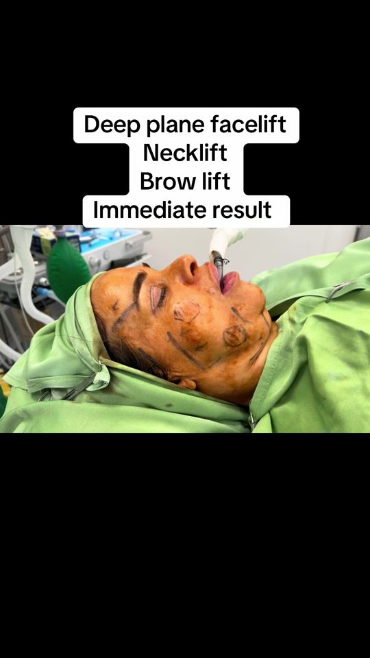 TikTok video thumbnail by dramradelosman