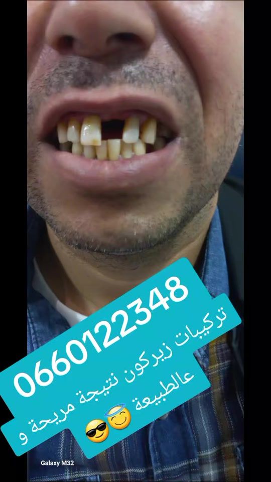 TikTok video thumbnail by uservz0srcxr6c