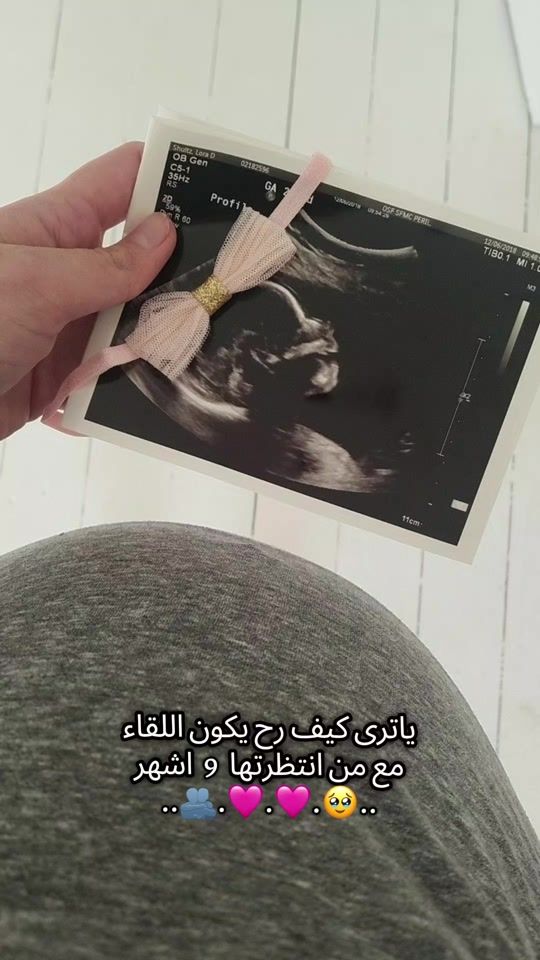 TikTok video thumbnail by wiaam_4