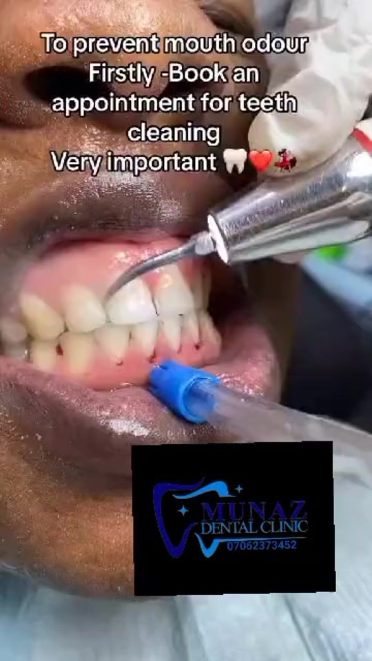TikTok video thumbnail by rdth_abdallah