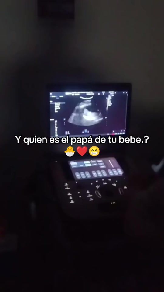 TikTok video thumbnail by 01_anais