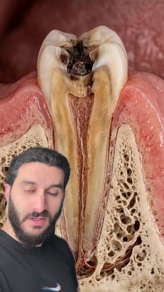 TikTok video thumbnail by abdulrahmanalakrami