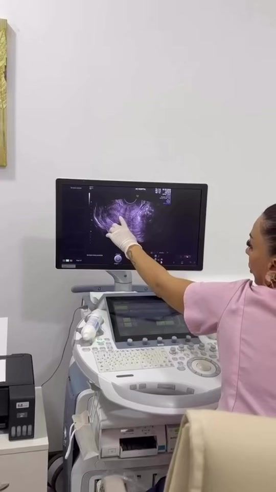 TikTok video thumbnail by dr.aysel_ibrahimova