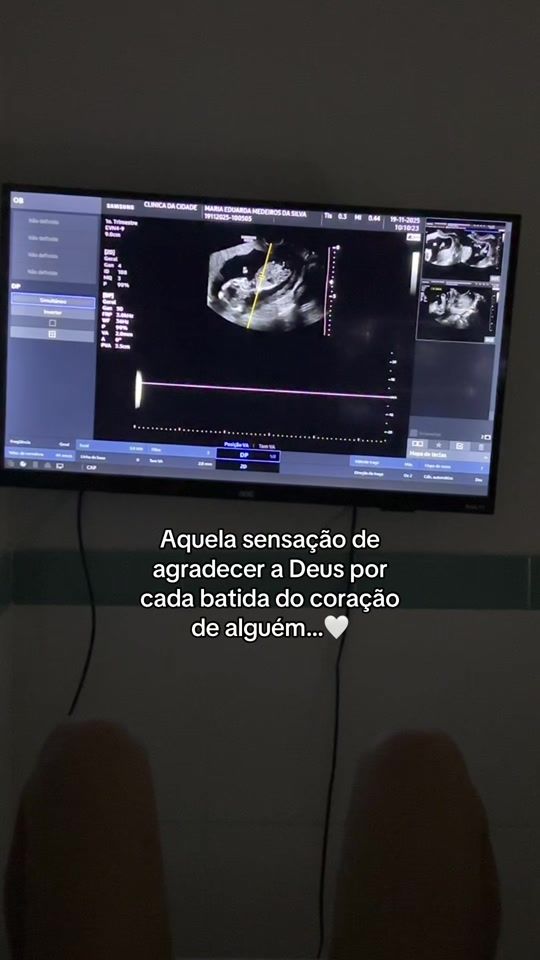 TikTok video thumbnail by madumedeirox